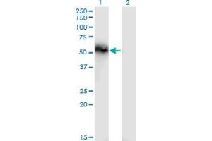 Western Blot analysis of TNS4 expression in transfected 293T cell line by TNS4 monoclonal antibody (M01), clone 3B8.