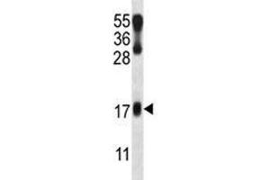 Image no. 2 for anti-LIM Domain Only 2 (Rhombotin-Like 1) (LMO2) (AA 1-30) antibody (ABIN3031621)