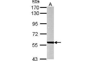 Image no. 4 for anti-UDP-Glucose 6-Dehydrogenase (UGDH) (Center) antibody (ABIN2856009)