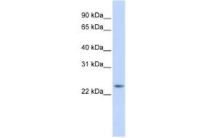 Image no. 1 for anti-RAB8A, Member RAS Oncogene Family (RAB8A) (Middle Region) antibody (ABIN2792290)