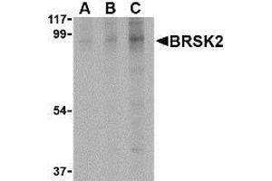 Image no. 2 for anti-BR serine/threonine Kinase 2 (BRSK2) (C-Term) antibody (ABIN499503)