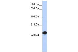 Image no. 1 for anti-Calcyphosine (CAPS) (N-Term) antibody (ABIN634437)