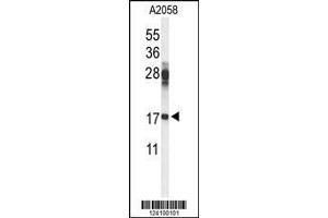 Image no. 1 for anti-Ribosomal Protein S11 (RPS11) (AA 80-108) antibody (ABIN653586)