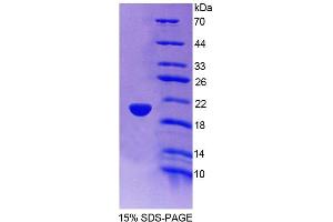 Image no. 1 for Tripartite Motif Containing 3 (TRIM3) (AA 2-152) protein (His tag) (ABIN6239058)