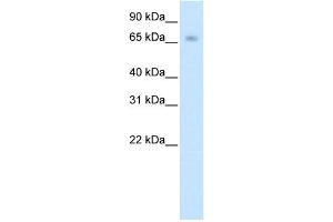 Image no. 1 for anti-Kelch-like protein 41 (KLHL41) (N-Term) antibody (ABIN2780740)