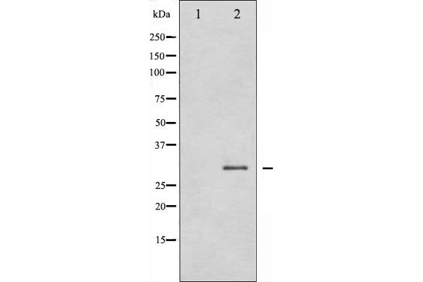anti-SNAIL (SNAI1) (C-Term) antibody