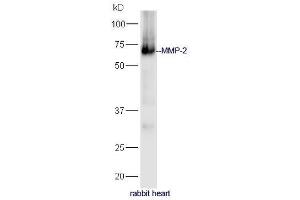 Image no. 2 for anti-Matrix Metalloproteinase 2 (MMP2) (AA 401-500) antibody (ABIN707426)