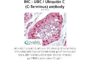 Image no. 2 for anti-Ubiquitin C (UBC) (C-Term) antibody (ABIN2852400)