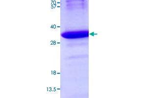 Image no. 1 for Ornithine Decarboxylase Antizyme 1 (OAZ1) (AA 1-228) protein (His tag) (ABIN5570423)