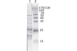HIV-1 Tat antibody  (AA 2-9)