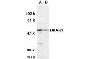 Image no. 2 for anti-serine/threonine Kinase 17a (STK17A) (AA 5-19) antibody (ABIN189896)