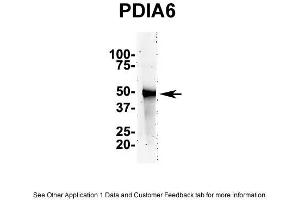 Image no. 1 for anti-Protein Disulfide Isomerase Family A, Member 6 (PDIA6) (N-Term) antibody (ABIN2784775)