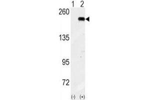 Image no. 2 for anti-Eukaryotic Translation Initiation Factor 2 alpha Kinase 4 (EIF2AK4) (AA 1-30) antibody (ABIN3028641)