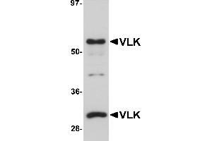 Western Blotting (WB) image for anti-Protein Kinase Domain Containing, Cytoplasmic Homolog (Mouse) (PKDCC) (Middle Region) antibody (ABIN1031161)