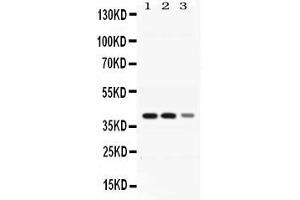 Image no. 1 for anti-Alcohol Dehydrogenase 4 (Class II), pi Polypeptide (ADH4) (AA 218-380) antibody (ABIN4886428)