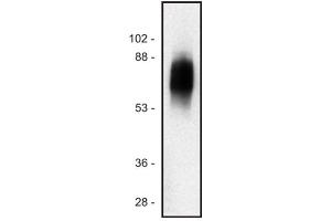 Image no. 1 for anti-Signaling threshold Regulating Transmembrane Adaptor 1 (SIT1) antibody (ABIN94465)