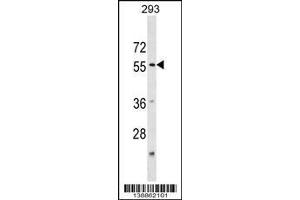 Image no. 1 for anti-Katanin P60 (ATPase Containing) Subunit A 1 (KATNA1) (AA 59-85), (N-Term) antibody (ABIN1539482)