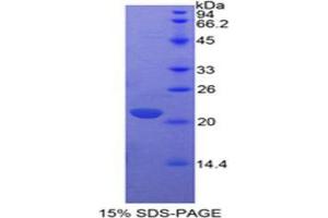 Image no. 1 for Interleukin 17 (IL17) (AA 1-155) protein (His tag) (ABIN1879031)