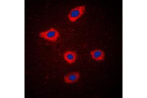 Image no. 2 for anti-Secretoglobin, Family 2A, Member 2 (SCGB2A2) (Center) antibody (ABIN2706503)