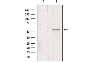 anti-Kynurenine 3-Monooxygenase (Kynurenine 3-Hydroxylase) (KMO) (Internal Region) antibody
