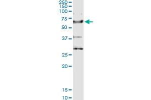 Image no. 1 for anti-Interleukin 18 Receptor 1 (IL18R1) (AA 1-541) antibody (ABIN948735)