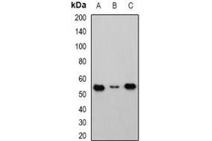 Image no. 1 for anti-Cbl proto-oncogene C (CBLC) (full length) antibody (ABIN6004488)