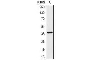 Image no. 1 for anti-Absent in Melanoma 2 (AIM2) (Center) antibody (ABIN2705417)