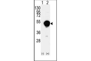 Image no. 1 for anti-Cytochrome P450, Family 20, Subfamily A, Polypeptide 1 (CYP20A1) (C-Term) antibody (ABIN359617)