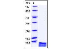 Image no. 1 for Chemokine (C-C Motif) Ligand 17 (CCL17) (full length), (AA 1-94) protein (His tag) (ABIN2002399)