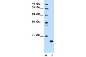Image no. 2 for anti-Complement Component 8, beta Polypeptide (C8B) (C-Term) antibody (ABIN2781764)
