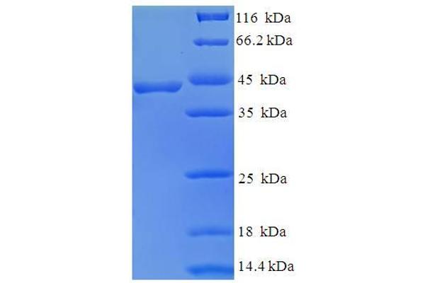 BEND3 Protein (AA 328-461, partial) (GST tag)