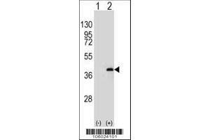 Image no. 1 for anti-Protein Phosphatase 1, Catalytic Subunit, beta Isoform (PPP1CB) (AA 286-315), (C-Term) antibody (ABIN392847)