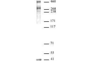 Image no. 1 for anti-Nuclear Receptor Co-Repressor 2 (NCOR2) (N-Term) antibody (ABIN6972762)