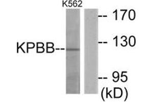 Image no. 1 for anti-Phosphorylase Kinase, beta (PHKB) (AA 661-710) antibody (ABIN1534055)