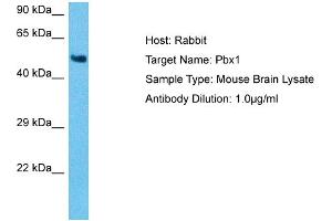 Image no. 1 for anti-Pre-B-Cell Leukemia Homeobox Protein 1 (PBX1) (N-Term) antibody (ABIN2777186)