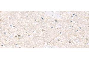 Immunohistochemistry of paraffin-embedded Human brain tissue using ANKS6 Polyclonal Antibody at dilution of 1:55(x200)