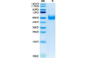 Image no. 5 for Interleukin 17 Receptor B (IL17RB) protein (His tag) (ABIN7274891)