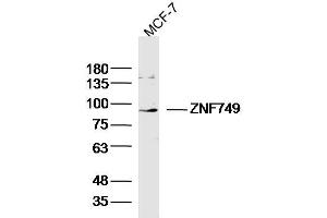 Image no. 1 for anti-Zinc Finger Protein 749 (ZNF749) (AA 151-250) antibody (ABIN5675710)