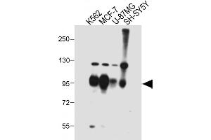 SEMA4C antibody  (AA 792-821)