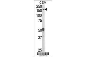 Western Blotting (WB) image for anti-Contactin Associated Protein-Like 2 (CNTNAP2) antibody (ABIN2158309)