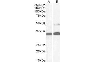 Image no. 3 for anti-Paired Box 8 (PAX8) (N-Term) antibody (ABIN184783)