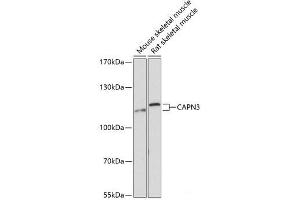 Western blot analysis of extracts of various cell lines using CAPN3 Polyclonal Antibody at dilution of 1:3000.