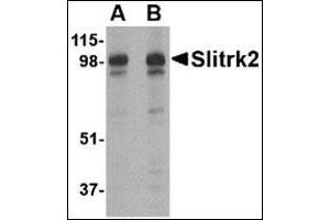 Image no. 2 for anti-SLIT and NTRK-Like Family, Member 2 (SLITRK2) (C-Term) antibody (ABIN500754)