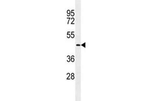 Image no. 2 for anti-Transmembrane Protease, serine 11E (TMPRSS11E) (AA 249-277) antibody (ABIN3029259)