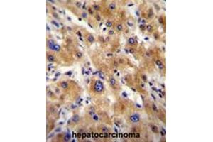 Image no. 3 for anti-alpha-2-HS-Glycoprotein (AHSG) (AA 254-284), (C-Term) antibody (ABIN950366)