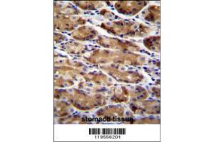 Image no. 2 for anti-Autophagy Related 16-Like 2 (ATG16L2) (Center) antibody (ABIN2159330)