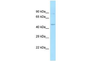 Image no. 1 for anti-Sorting Nexin 6 (SNX6) (Middle Region) antibody (ABIN2790092)