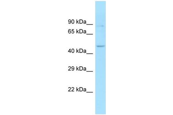 anti-Sorting Nexin 6 (SNX6) (Middle Region) antibody
