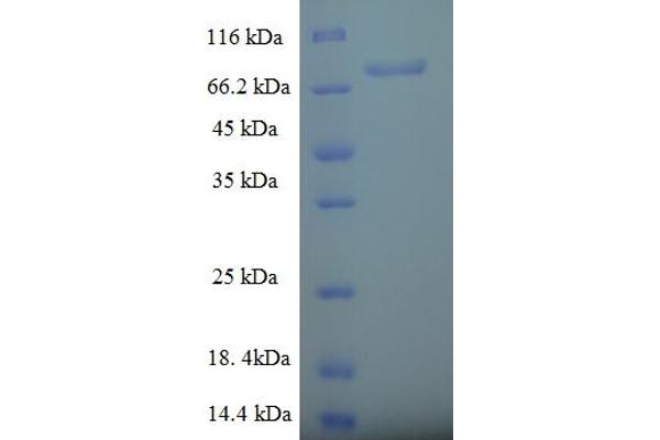 RABGEF1 Protein (AA 1-491, full length) (His-SUMO Tag)