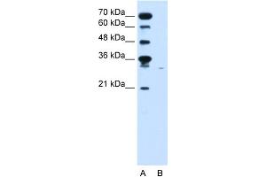 Image no. 1 for anti-Solute Carrier Family 22 (Organic Cation Transporter), Member 7 (SLC22A7) (C-Term) antibody (ABIN2775547)